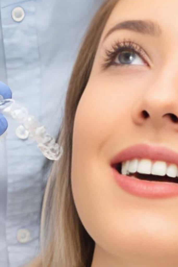 Blanchiment Dentaire