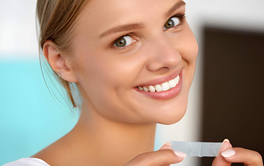 Blanchiment Dentaire
